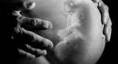 Почему возникают врожденные пороки развития? IsMama беременность