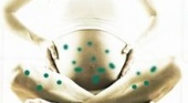 Ветряная оспа и беременность IsMama беременность